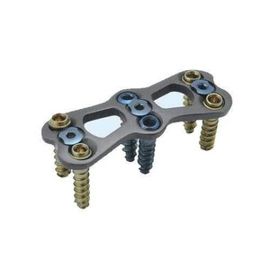 Sistema de Implantes Ortopédicos Profesionales para Fijación de Fracturas y Procedimientos Reconstructivos - Product Image 4
