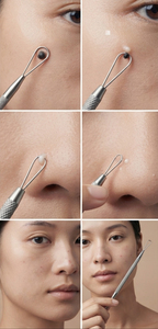 Stainless Steel Pimple Remover Tool Blackhead Extractor Needle Popper Tool - Product Image 4