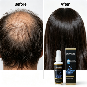 Aceite Capilar Orgánico de Marca Privada con Concentración Herbal al 5%, Anti-Caída, Reparador, Nutritivo y Refrescante, con Queratina y Argán - Product Image 6