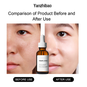 Squalano 1% a Marchio Privato per Siero Viso Leggero Anti-Età, Levigante e Idratante per Tutti i Tipi di Pelle, Delicato per Uso Quotidiano - Product Image 2