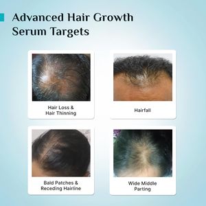 Pilgrim Redensyl 3% + Anagain 4% + 5% Capilia Stem Advanced Hair Growth Serum - 1.01 fl oz (30 ml) - Product Image 5