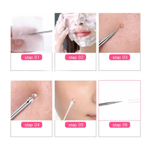 Professional 1pc Stainless Steel <b>Blackhead</b> Comedone Acne Blemish Extractor Remover Face Skin Care Pore <b>Cleaner</b> - Product Image 2