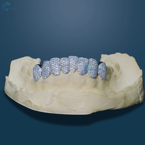 Hip Hop Lab Grown Diamond Teeth Grillz Iced Out 8 Top & 8 Bottom Set Personalizado de Oro Blanco Sólido de 14K para Hombre - Product Image 3