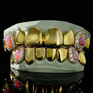 กริลล์ซ์ชุบทอง 24K ประดับเพชรโมอิสซาไนต์ พร้อมเพชรตกแต่ง รับรองโดย IGI แบบ Claw Set สไตล์ฮิปฮอป เครื่องประดับฟันแฟชั่นสำหรับผู้ชาย - Product Image 1