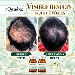 Suero Capilar Orgánico Natural Renexo 2026 con Exosomas, Péptidos de Cobre, Anticaída, Nutritivo para el Cuero Cabelludo y Fortalecedor del Cabello - Product Image 1