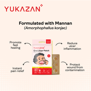 Patchs Yukazan pour ulcères buccaux, 6 unités, Meilleure vente en Malaisie, Qualité supérieure garantie par le meilleur fournisseur, Soulagement de la douleur et soin des plaies buccales - Product Image 4