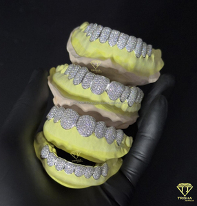 Grillz personnalisés faits à la main en opale, moissanite et diamant, en argent 925, bijoux dentaires sertis de pierres, livraison rapide - Product Image 3