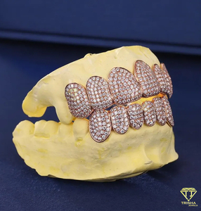 Grillz personnalisés haut de gamme en argent 925 avec moissanite VVS, ajustement sur mesure, entièrement sertis de pierres, kit de moulage gratuit et livraison rapide - Product Image 2