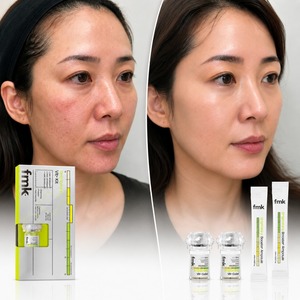 ชุดเซรั่ม PDRN 500000ppm HA Cube Ampoule Kit ลดเลือนริ้วรอย กระชับผิว ยืดหยุ่นได้ 114% ผลลัพธ์ใน 2 สัปดาห์ ผลิตภัณฑ์บำรุงผิวหน้าแบบเกาหลี ยกกระชับผิว ใช้ได้ที่บ้าน - Product Image 1