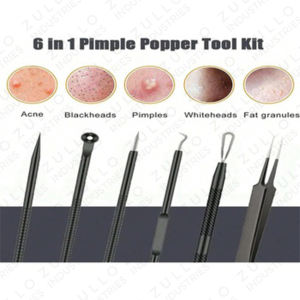 Kit d'extraction faciale professionnel, produit très demandé, kit d'élimination des points noirs, outils de soin de l'acné, ensemble avec logo personnalisé - Product Image 2