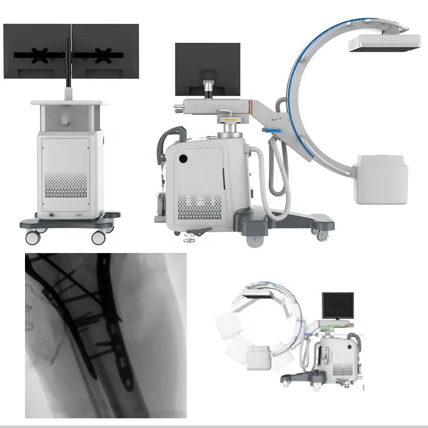 5.0KW 디지털 C 암 X 레이 기계/다목적 수술대 c-암 엑스레이 호환 방사선 진단