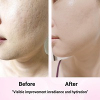 [GLOWAID] Baume hydratant Glow Ever à la Panthénol, testé par des dermatologues, formule douce pour les peaux sensibles