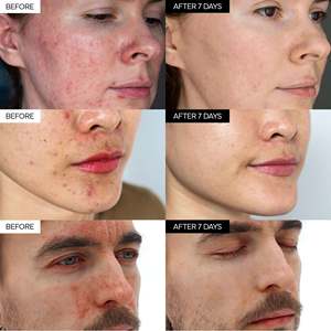 ครีมซ่อมแซมเข้มข้นครีมเกาหลี dexpanthenol ครีมผ่อนคลายที่อุดมไปด้วย madecassozide - Product Image 4