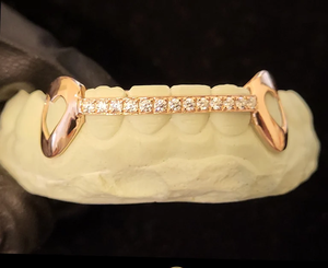 Grillz dentaire plaqué or 22 carats pour homme avec sertissage de diamants ronds en forme de cœur, style hip-hop, bijoux corporels pour usage quotidien - Product Image 4