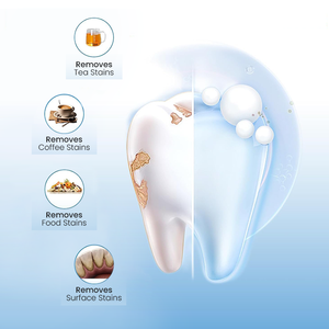 Gel blanchissant pour les dents Opalescence PF 10% peroxyde de carbamide, saveur menthe, faible sensibilité, pour un blanchiment des dents à domicile sûr et efficace - Product Image 6