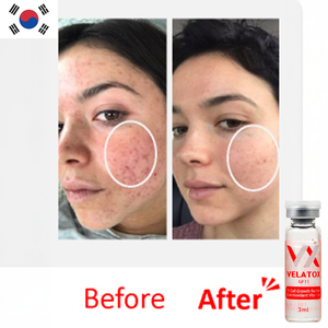 Suero Reparador de Piel con Colágeno Nano Liposomado y Vitamina C VELATOX, Factor de Crecimiento, Complejo Vitamínico, Antiarrugas, Reafirmante e Iluminador - Product Image 1