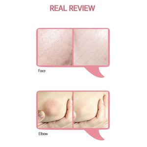 Crema Facial y Corporal con Niacinamida para el Cuidado de la Piel con Melasma, Crema Coreana para el Cuidado de la Piel, Tónico, Suero, Cosméticos Faciales, 20 kg - Product Image 3