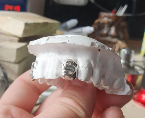 Grillz dentaire plaqué argent massif 925 avec résine bleue, violette et blanche, en contenants, unisexe - Product Image 2