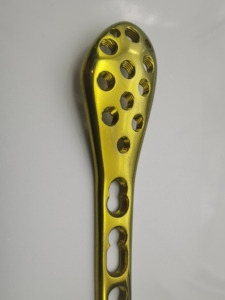 Factory Price Orthopedic Surgical Medical Implant Proximal Lateral Tibia Fracture Locking Plate Set - Product Image 6