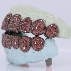 Juego Completo de Grillz Dentales de Moissanita Chapados en Oro de 18K con Microincrustaciones, Joyería Corporal de Lujo, Regalo Unisex para Fiestas y Uso Diario - Product Image 2