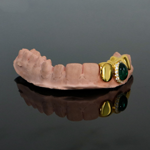 Gorra Grillz con Gema de Esmeralda |   Grillz Dentales de Oro Amarillo de 14K con Diamantes Personalizados - Product Image 1