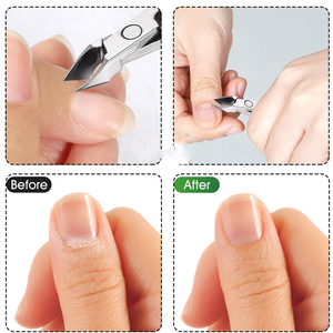 Cortauñas de Acero Inoxidable, Cortador de Uñas Encarnadas Profesional - Product Image 6