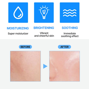 Suero Hidratante Multi-Hialurónico, Ampolla Acondicionadora Facial Diaria para el Cuidado de la Piel OEM ODM - Product Image 5