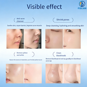 Appareil professionnel 3 <span class=keywords><strong>en</strong></span> 1 de mésothérapie Dermashine Pro 4ème génération pour <span class=keywords><strong>le</strong></span> raffermissement de la peau, anti-âge, 9 aiguilles, étanche, pour <span class=keywords><strong>le</strong></span> <span class=keywords><strong>visage</strong></span> et la tête - Product Image 4