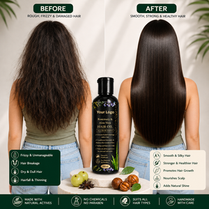 Aceite Capilar de Romero y Aloe Vera con Tu Logotipo, 200 ml, Aceite Natural a Base de Hierbas para el Crecimiento del Cabello, para Todo Tipo de Cabello, Prevención de la Caída del Cabello - Product Image 1