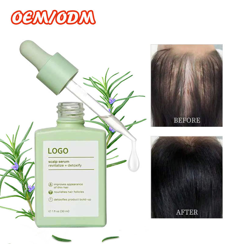 Herbal 5 Hair Growth Serum for