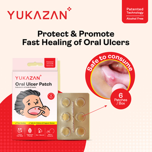 Patchs Yukazan pour ulcères buccaux, 6 unités, Meilleure vente en Malaisie, Qualité supérieure garantie par le meilleur fournisseur, Soulagement de la douleur et soin des plaies buccales - Product Image 2
