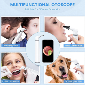 Otoscope chirurgical manuel en acier inoxydable pour examen médical de l'oreille, conçu pour l'évaluation du conduit auditif en milieu hospitalier - Product Image 6