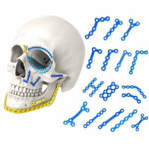 Placas de Fijación Craneofacial, Juego de 16 Piezas, Azul y Amarillo, Instrumentos Quirúrgicos Ortopédicos para Reparación de Huesos Faciales - Product Image 2