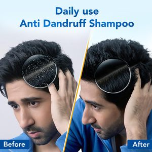 Scalpe Pro Daily Anti-Dandruff <b>Shampoo</b> | Removes Dandruff from Source | For Women & Men | (3.38floz)100ml - Product Image 3