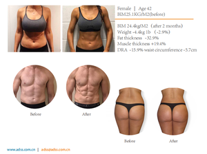 ADSS en kaliteli yapı ems stimülasyon yağ brülör kilo kaybı vücut zayıflama vücut şekillendirme makinesi - Product Image 6