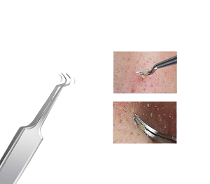 Pinzas para Puntos Negros, Extractor de Puntos Negros y Espinillas, Pinzas Curvas para Eliminar Puntos Negros y Espinillas - Product Image 2