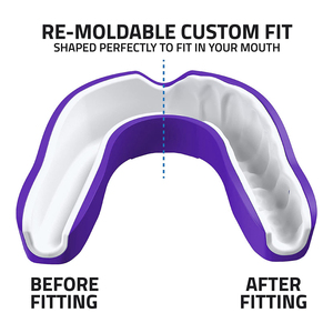 Latest Wholesale Silicone <b>Mouth</b> <b>Guard</b> Protective <b>Sports</b> Gear Boxing Adults Washable Non-Toxic Lightweight Solid Color Customized - Product Image 2