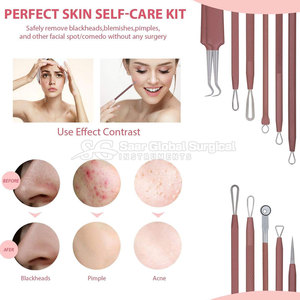 Premium Blackhead <b>Remover</b> Kit For Deep Pore Care With Precision Tools And Personal Skincare Blackhead <b>Remover</b> Kit - Product Image 4