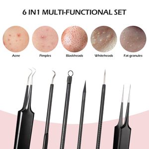 Kit de Herramientas para Eliminar Puntos Negros, Extractor de Puntos Negros de Calidad Profesional, Kit de Herramientas para Eliminar Espinillas para Nariz, Rostro, Piel, Imperfecciones Extra - Product Image 3