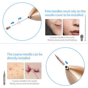 Stylo anti-taches rechargeable par USB, outil de beauté portable en plastique pour l'élimination des verrues, des taches de naissance et des tatouages - Product Image 6