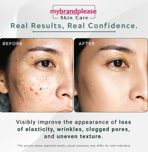 สควาเลน + กรดไฮยาลูโรนิก อุดมด้วยกรดไฮยาลูโรนิก วิตามินอี สควาเลน และเรตินอล - Product Image 6