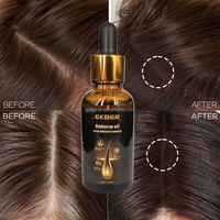 EKBER Etiqueta Privada Orgánica Natural Cuero Cabelludo Pérdida de Cabello Jengibre Biotina Aceite de Botana Aceite PARA EL Cabello 100 Puro Crecimiento de Cabello Crudo