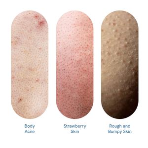 Be-Bodywise Gel Douche Exfoliant à l'Acide Salicylique à 1% - 8.45floz (250ml) |   Peau rugueuse et nettoyage en profondeur - Product Image 3