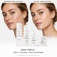 Kit de Soins de la Peau 4 Pièces OEM au Ferment de Riz : Tonique, Brume, Sérum, Crème Hydratante, Apaisante et Éclaircissante