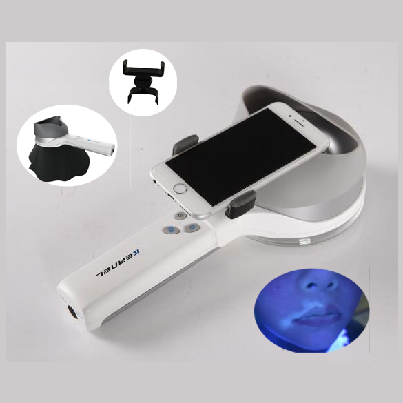 Medical Woods Lamp UV Skin Analyzer Dermatoscope for Vitiligo Psoriasis Skin Examination Device KN-9000B
