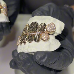 Grillz dentaire en or massif 18 carats, ensemble complet, pierres naturelles taille brillant rond, sertissage en canal, style hip-hop, unisexe, pour usage quotidien - Product Image 2