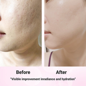 [GLOWAID] Bálsamo Multiusos Glow Ever Moisturizer con Pantenol y Vitamina B12 para Reparación de la Barrera Cutánea, Calmante e Hidratante - Product Image 6