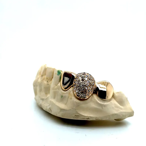 Grillz en argent 925 et moissanite, sur mesure, pour hommes et femmes, collection de bijoux de mode - Product Image 2