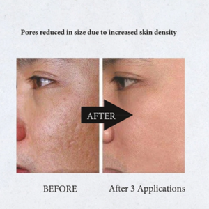 Sérum Rajeunissant ADN de Saumon PDRN 5% Booster Cutané Acide Hyaluronique Glutathion Essence Éclaircissante Réparatrice - Product Image 2