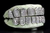 Orave Luxury Christian Diamond Grillz de Plata 925 con Corte Princesa, Escaneo Dental 3D, Proceso Rápido, Personalizado con Diamantes VVS, Invisible, para Hombre